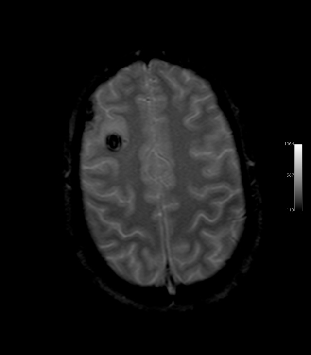 One of the many TBI scans following my hospital admission on May 31, 2006. 